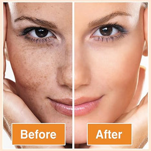 LLEVA 2 JABÓN DE CÚRCUMA 100% NATURAL - ENVIO GRATIS