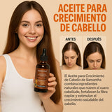 SERUN CAPILAR SAMANTHA - CRECE CABELLO 💁