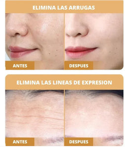 PARCHES DE COLÁGENO BEAUTY PATCH | 100% EFECTIVO