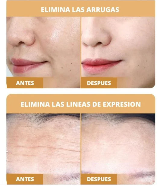 PARCHES DE COLÁGENO BEAUTY PATCH | 100% EFECTIVO